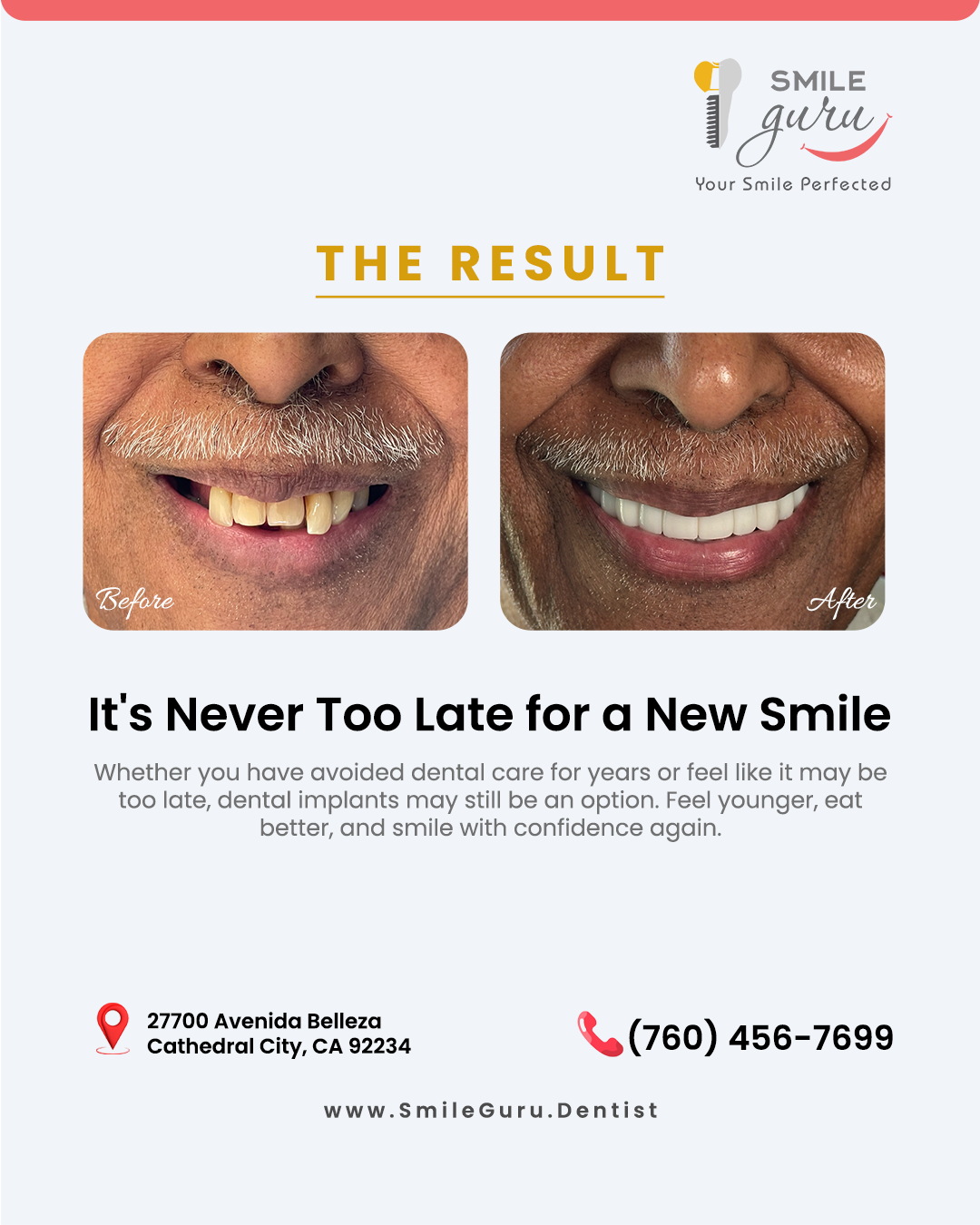 Dental Implants Can Restore Confidence at Any Age